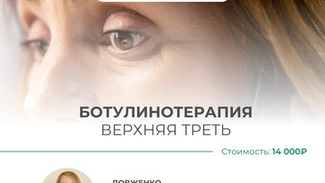 Ботулинотерапия: Верхняя треть